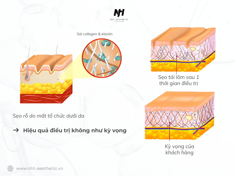 hieu qua dieu tri seo khong nhu ky vong