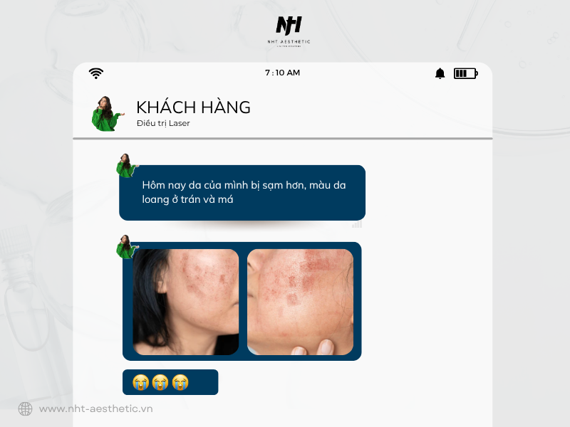 Tang sac to sau xam lan